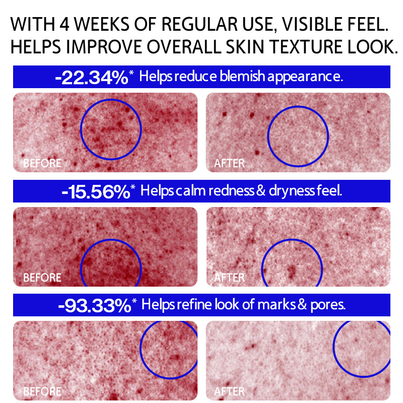 EHDOC Acne and Mite-Removing Shower Gel