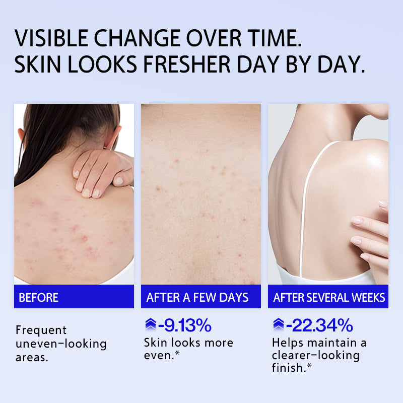 EHDOC Acne and Mite-Removing Shower Gel