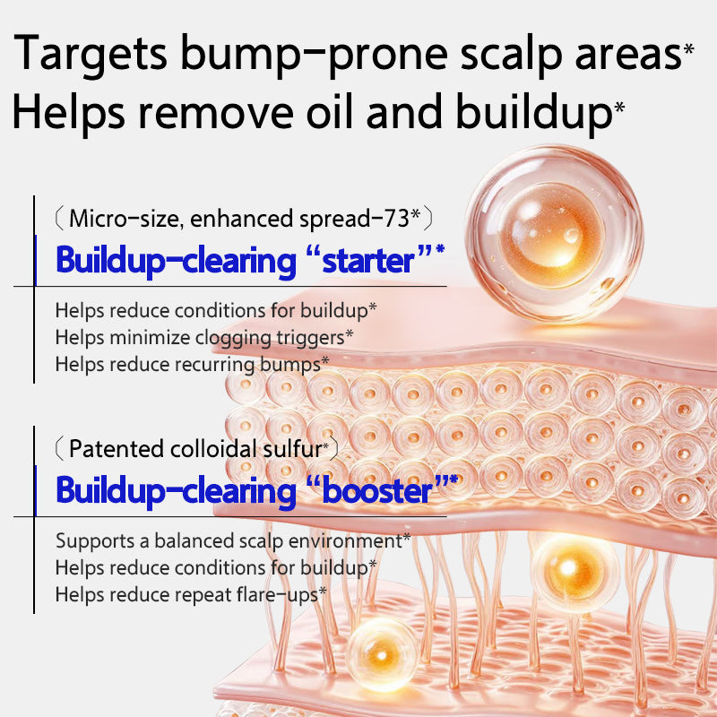 EHD Oil Control and Acne-Fighting Shampoo